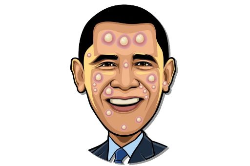 Celebrity Pimple Pop game on Video-Igrice.com