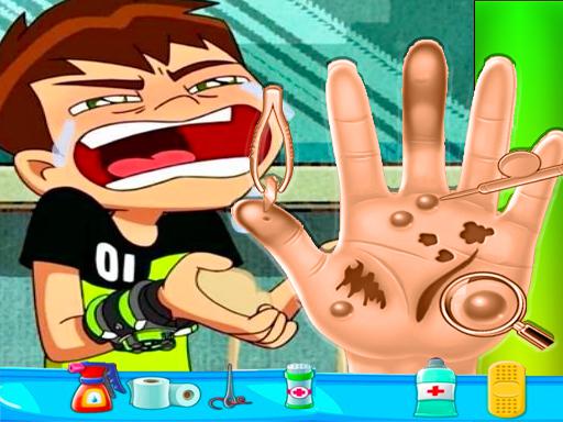 Ben10 Hand Doctor game on Video-Igrice.com